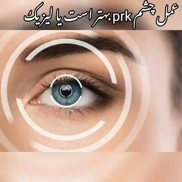 عمل چشم prk بهتر است یا لیزیک