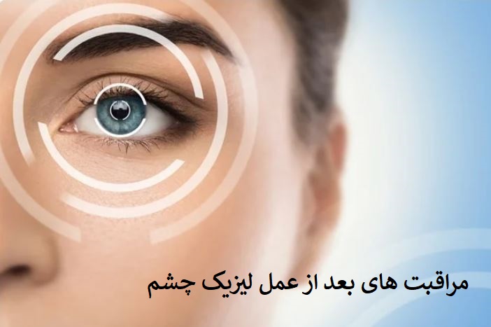 مراقبت های بعد از عمل لیزیک، لازک و فمتولیزیک