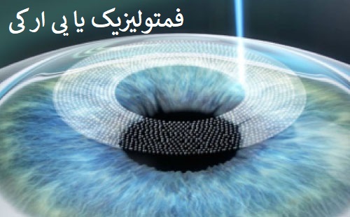 فمتولیزیک یا پی ار کی