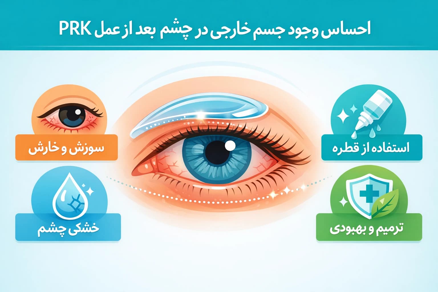 احساس وجود جسم خارجی در چشم بعد از عمل prk