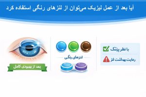 ایا بعد از عمل لیزیک میتوان از لنز رنگی استفاده کرد