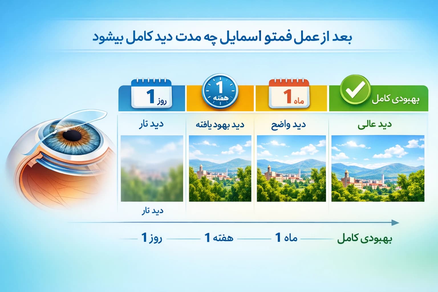 بعد از عمل فمتو اسمایل چه مدت دید کامل میشود