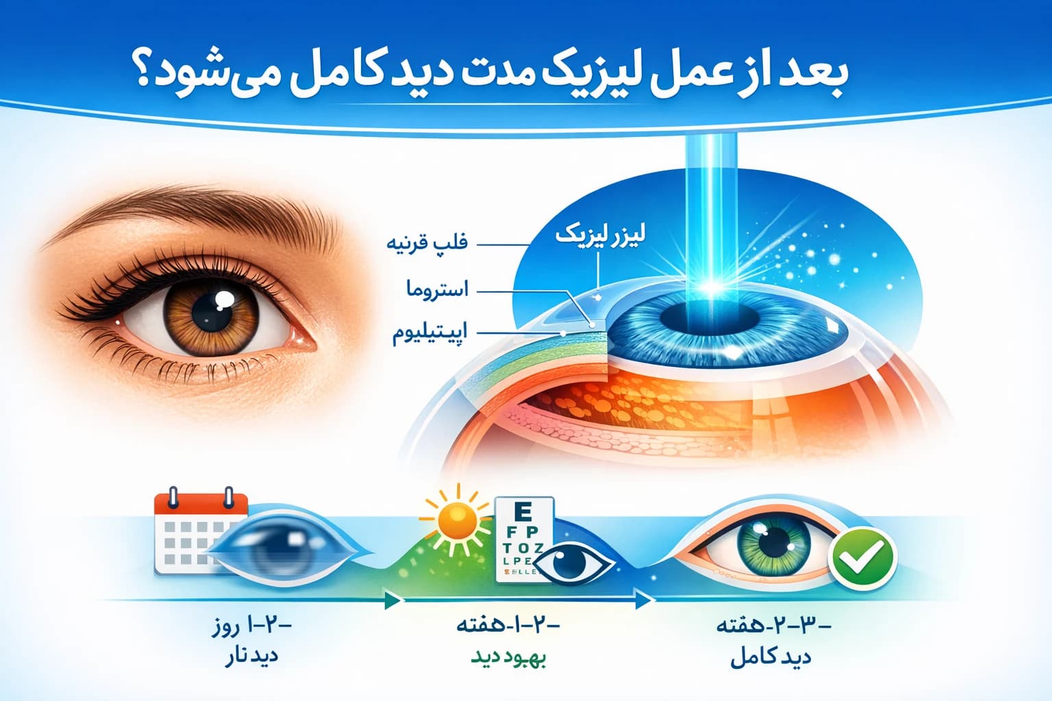 بعد از عمل لیزیک چه مدت دید کامل میشود