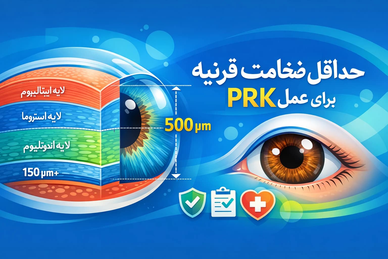 حداقل ضخامت قرنیه برای عمل prk