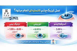 عمل لیزیک چشم تا چه شماره ای انجام میشود