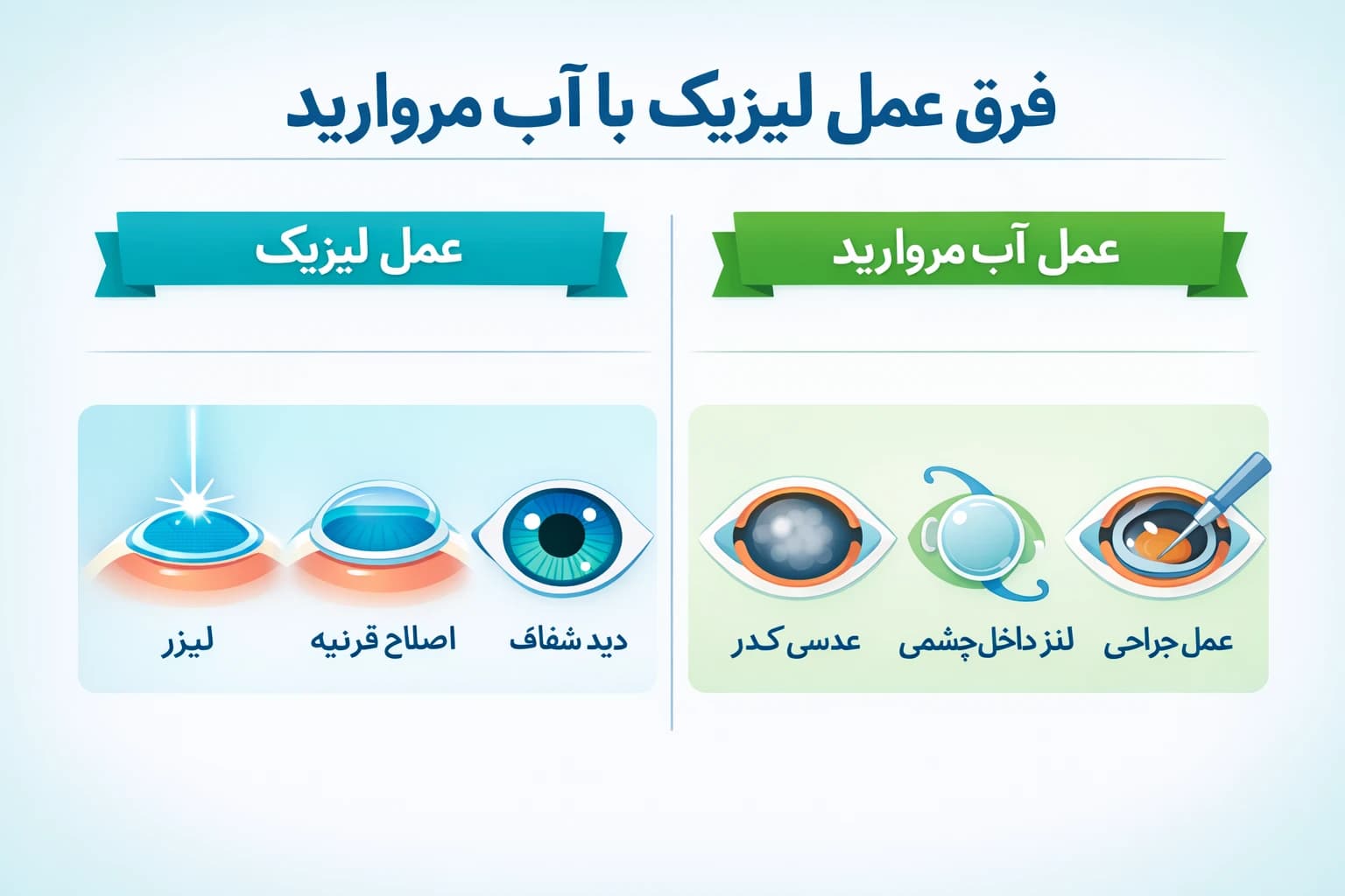 فرق عمل لیزیک با آب مروارید