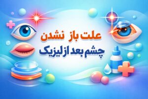 علت باز نشدن چشم بعد از لیزیک