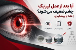 آیا بعد از عمل لیزیک چشم ضعیف می‌شود؟ | علت و پیشگیری